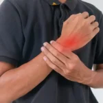Carpal Tunnel Syndrome