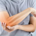 Tendonitis